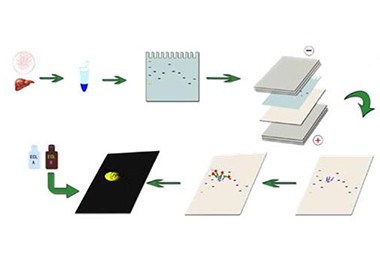 Western Blot