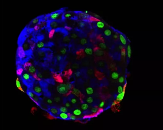Nature：为治疗糖尿病，科学家们让细胞“改变身份”