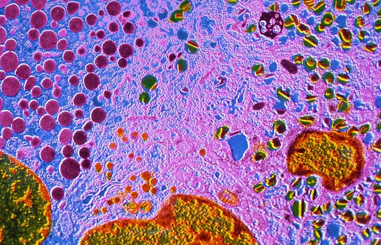 Nature：为治疗糖尿病，科学家们让细胞“改变身份”