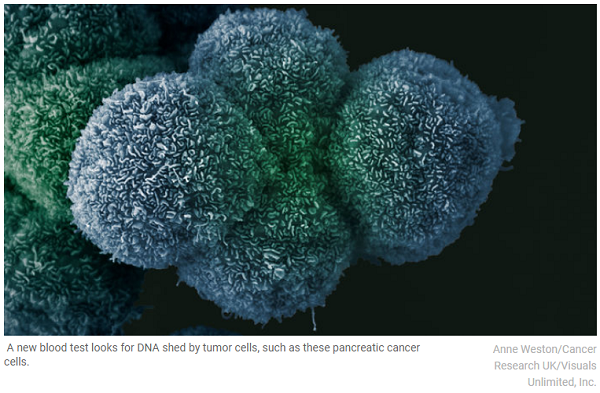 迈出一大步！Science：一种血液测试，可检测8种癌症