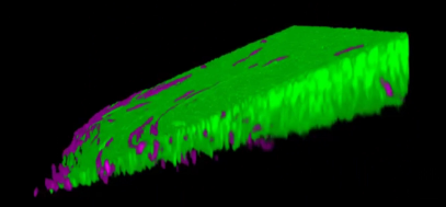 Cell子刊：细菌大战没有投降一说，打不过就发动自杀式袭击