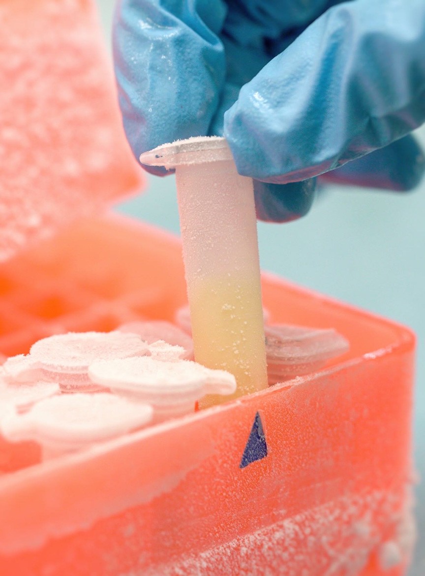 Recombinant Antibodies