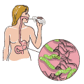 13C Urea Breath Test Kit For H. Pylori Diagnosis (75mg) 13C Urea Breath Test Kit For H. Pylori Diagnosis (75mg)