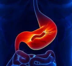 How To Effectively Avoid H.Pylori Infection?