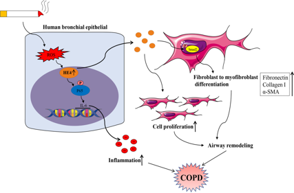A new marker for ovarian cancer detection HE4
