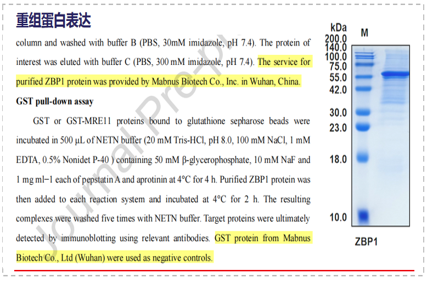 ZBP1 can antagonize the DNA end excision mediated by MRE11