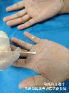 皮肤性病科 皮肤性病科