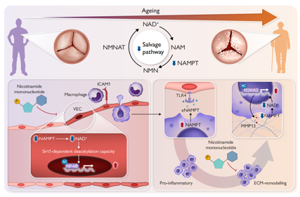 Senescence-associated metabolic alterations aggravate calcific aortic valve disease