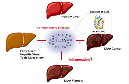 The proinflammatory cytokine IL20