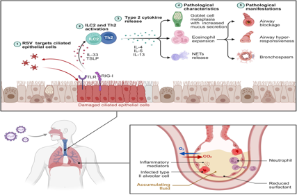 Respiratory syncytial virus RSV