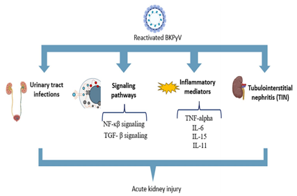 Polyomavirus BKV